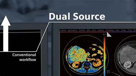 dszcvt|Dual Source CT .